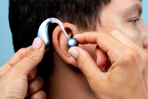 How to Care for Your Cochlear Implant After Surgery